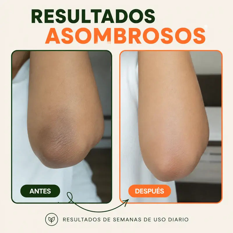ALMOHADILLAS EXFO Y DESPIG-JIYU